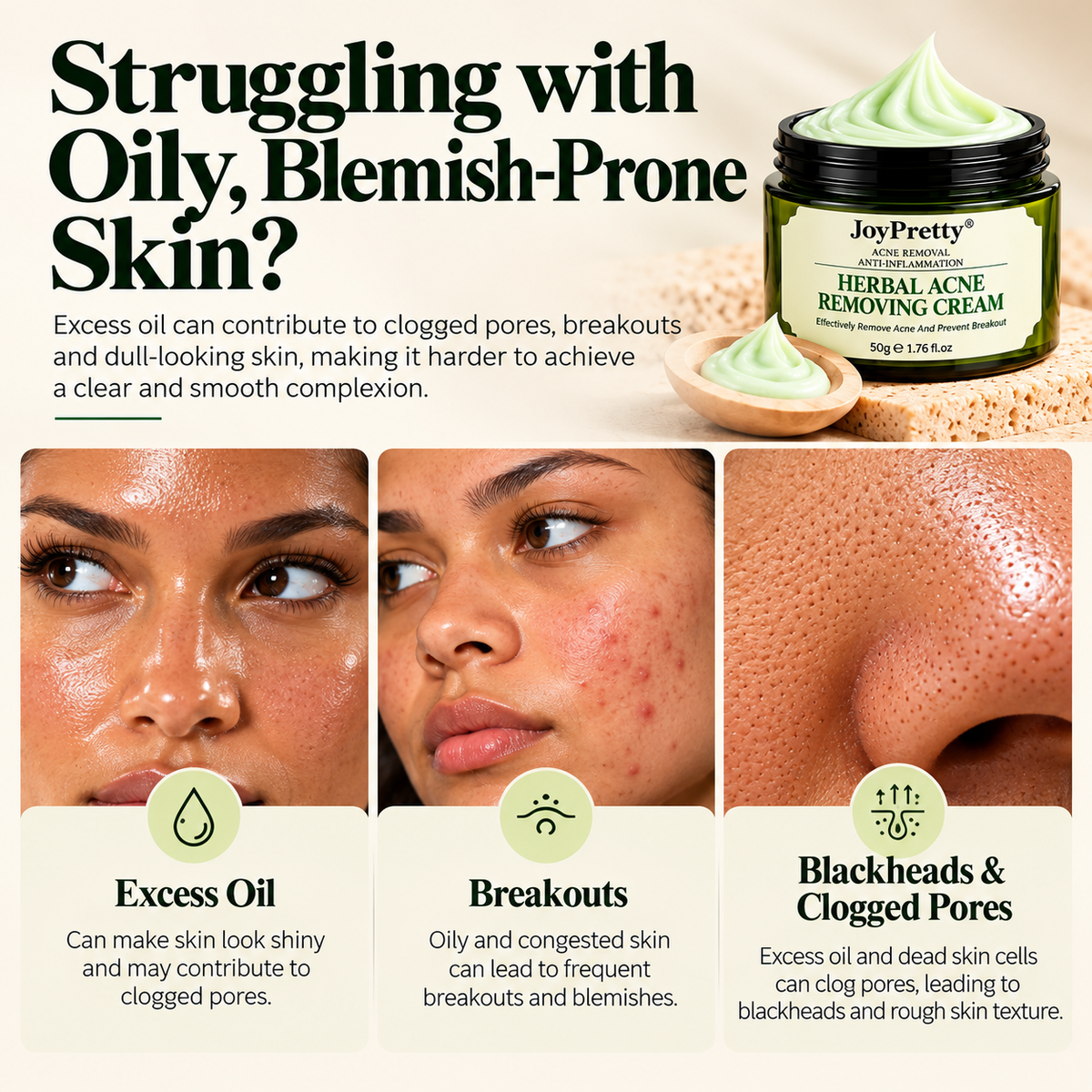 Herbal Acne Removing Cream